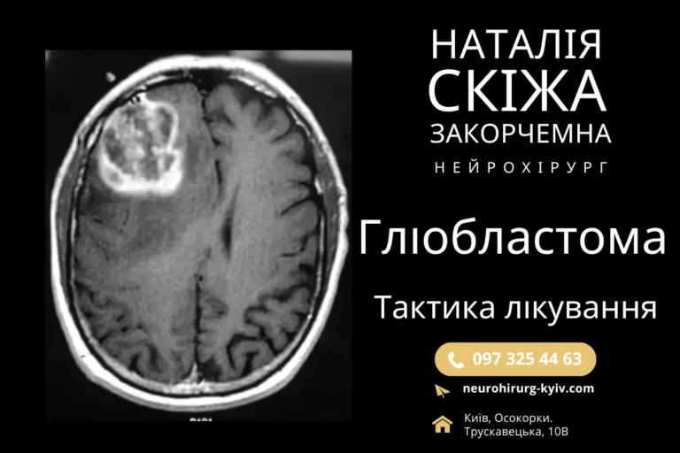 Гліобластома. Київ Лікування гліобластоми консультує нейрохірург Скіжа Наталія