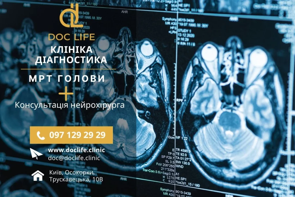 Як підготуватися до МРТ головного мозку? Як підготуватися до МРТ головного мозку?