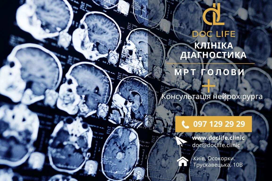 МРТ головного мозку: що показує, як підготуватися і скільки коштує в Києві МРТ головного мозку: що показує, як підготуватися і скільки коштує в Києві - Нейрохірург Наталія Скіжа Київ