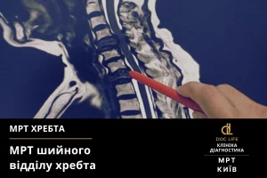 Протрузія міжхребцевих дисків C4–C5: консультація нейрохірурга - Нейрохірург Наталія Скіжа Київ