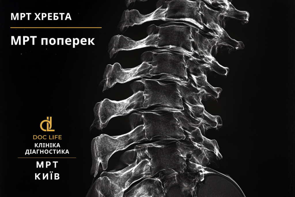 Перелік хвороб хребта, які дають право на звільнення зі служби 2025 Перелік хвороб хребта, які дають право на звільнення зі служби 2025 - Нейрохірург Наталія Скіжа Київ