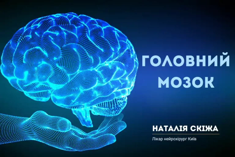 Головний мозок Кибірніж Скіжа Наталія