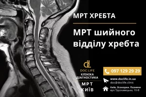 МРТ шийного відділу хребта Київ - МРТ хребта МРТ спини Київ осокорки Позняки