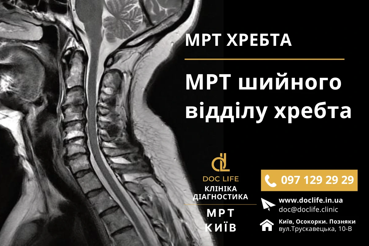 МРТ шийного відділу хребта: сучасні методи діагностики та лікування МРТ шийного відділу хребта Київ - МРТ хребта МРТ спини Київ осокорки Позняки