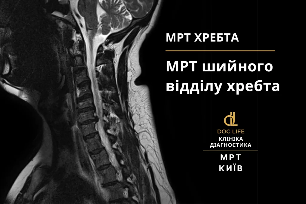 МРТ шийного відділу хребта: сучасні методи діагностики та лікування МРТ шийного відділу хребта: сучасні методи діагностики та лікування