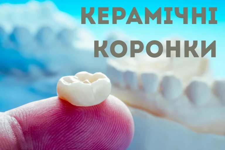 Як виготовляють і встановлюють керамічні коронки 1