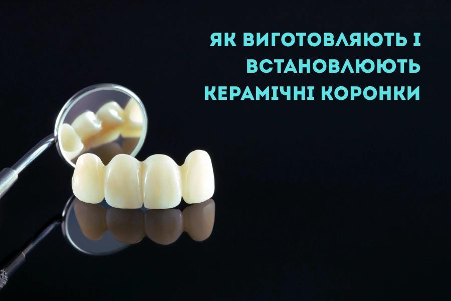 Як виготовляють і встановлюють керамічні коронки Як виготовляють і встановлюють керамічні коронки