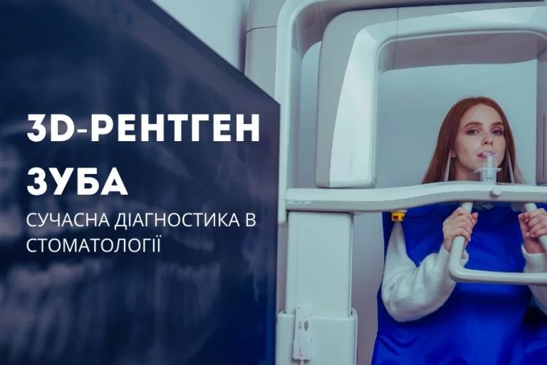 3Д рентген зуба 1