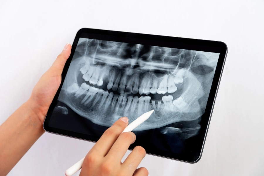 3D-рентген у Viva Clinic