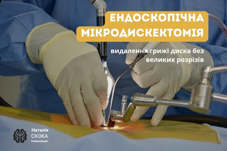 Ендоскопічна мікродискектомія 7