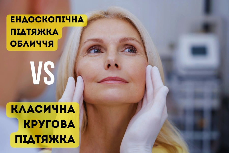Коли м’які тканини обличчя опускаються, з’являються глибокі носогубні складки, втрачається чіткість овалу, хірургічна підтяжка стає дієвим способом покращити зовнішній вигляд. Сучасна естетична медицина пропонує кілька методик, серед яких найчастіше обирають класичну кругову підтяжку або менш інвазивну – ендоскопічну. Обидва варіанти мають свої переваги, протипоказання та різний реабілітаційний період. Варто розібратись, чим вони відрізняються та кому підходять. В клініці пластичної хірургіх Цетрус у Києві Фото: клініка пластичної хірургії Цертус, Київ Суть методів: у чому технічна різниця Хоча обидва методи мають на меті омолодження обличчя, підхід до їх виконання суттєво відрізняється. Це не лише про техніку – мова йде про рівень втручання, тривалість операції, потенційні ризики та тривалість ефекту. Розуміння цих нюансів дозволяє пацієнтові свідомо підійти до вибору й уникнути зайвих очікувань. Класична підтяжка частіше поєднується з ліпосакцією підборіддя або пластикою шиї, тоді як ендоскопічна – з блефаропластикою або ін'єкційними процедурами. Класична кругова підтяжка обличчя (або фейсліфтинг) – це хірургічне втручання, під час якого виконується розріз по лінії волосся, за вухами або у скроневій зоні. Хірург відокремлює м’язово-апоневротичний шар (SMAS), переміщує тканини, видаляє надлишки шкіри. Така методика ефективна при виражених вікових змінах: обвислі щоки, птоз нижньої третини обличчя, подвійне підборіддя, «бульдожі щоки». Ендоскопічна підтяжка передбачає використання тонких оптичних приладів через кілька невеликих проколів у волосистій частині голови. Камера дозволяє лікарю бачити тканини у збільшеному вигляді й працювати без великих розрізів. Ця методика підходить для пацієнтів із помірними віковими змінами, найчастіше – у лобово-скроневій частині, міжбрів’ї, надбрів’ях. Фото з портфоліо пластичного хірурга Дмитра Березовського Фото: пластичний хірург Дмитрий Березовский, Київ Варто зазначити, що ендоскопічна підтяжка - це відносно новий метод пластичних операцій. В процесі вибору клініки обов’язково почитайте відгуки пацієнтів про пластичних хірургів, щоб переконатись, що вони дісно мають досвід саме в таких втручаннях. Кому підходить кожна процедура Показання до класичної підтяжки обличчя: виражене опущення тканин; втрата чіткості овалу обличчя; наявність «бульдожих щік»; подвійне підборіддя; зморшки у зоні шиї та нижньої третини обличчя. Показання до ендоскопічної підтяжки: перші ознаки старіння (35-45 років); асиметрія брів чи чола; опущення лоба чи верхніх повік; зморшки у міжбрів’ї та скроневій зоні. Класичний фейсліфтинг обирають пацієнти віком від 45-50 років, коли зміни шкіри та гравітаційний птоз уже виражені. Методика дозволяє досягти стійкого ефекту на 8-12 років, але потребує більш тривалої реабілітації. Ендоскопічна підтяжка підходить тим, хто хоче профілактично втрутитись у процес старіння на ранніх стадіях – зазвичай у 35-45 років. Вона дозволяє усунути асиметрію, скоригувати положення брів, зменшити глибину зморшок у верхній частині обличчя. У деяких випадках ці дві методики комбінуються – наприклад, класичний фейсліфтинг нижньої третини + ендоскопічне втручання у верхній зоні. Відновлення та результат Рекомендації після класичної підтяжки: уникати фізичних навантажень на 3-4 тижні; не використовувати декоративну косметику протягом 10-14 днів; спати на спині з піднятою головою; не відвідувати сауну, солярій, басейн; проходити планові огляди у хірурга. Рекомендації після ендоскопічної підтяжки: уникати перегрівання обличчя; носити м’яку пов’язку за потреби; дотримуватись режиму сну та відпочинку; використовувати рекомендовані креми та антисептики. Після класичної підтяжки можливий набряк, синці, тимчасова втрата чутливості. Важливо суворо дотримуватися рекомендацій щодо фізичної активності, температурного режиму та догляду за прооперованими зонами. Пацієнтам рекомендують спати на спині, не нахиляти голову вниз і регулярно відвідувати післяопераційні огляди. Період реабілітації – від 2 до 4 тижнів. Шви знімають через 7-10 днів. Кінцевий результат можна оцінити через 2-3 місяці після операції. Після ендоскопічної підтяжки відновлення значно швидше: більшість пацієнтів повертаються до активного способу життя вже за 7-10 днів. Через відсутність великих швів не лишаються помітні рубці. Цей тип втручання вважається менш травматичним, однак важливо дотримуватися рекомендацій лікаря, особливо в перші дні після процедури. Перший ефект видно через 10 днів, стабілізація – за 1-2 місяці. Багато пацієнтів зазначають, що загальне самопочуття після ендоскопічної підтяжки значно краще, ніж після традиційної методики. Фото з портфоліо пластичного хірурга Сергія Кийло Фото: пластичний хірург Сергій Кийло, Київ Що врахувати при виборі Перед ухваленням рішення важливо оцінити кілька чинників: вік і стан шкіри, очікуваний ефект, доступність реабілітаційного періоду, кваліфікацію та досвід лікаря, а також вашу готовність дотримуватись рекомендацій. Ці аспекти впливають не лише на вибір методу, а й на безпечність процедури загалом. Вибір техніки залежить не лише від віку, а й від індивідуальних анатомічних особливостей та стану м’яких тканин. Важливо також враховувати супутні медичні стани, адже вони можуть впливати на тривалість відновлення або виключати деякі методики. У будь-якому разі перед операцією обов’язково потрібна очна консультація з пластичним хірургом. Надійний спеціаліст проаналізує вашу ситуацію, покаже результати попередніх робіт, пояснить реалістичні очікування від процедури та можливі ризики. Не варто орієнтуватися лише на вартість або короткий період реабілітації. Кожна методика має свої показання й обмеження, тому індивідуальний підхід – ключ до ефективного результату. Також важливо розуміти, що підтяжка не змінює риси обличчя, не робить обличчя «іншим», а лише повертає йому чіткіший контур, усуває ознаки втоми й вікові зміни. Операції в зоні обличчя потребують високої кваліфікації та досвіду, тому вибір клініки і хірурга – це основа якості майбутнього результату. При професійному підході ефект виглядає природно, гармонійно і зберігається надовго.