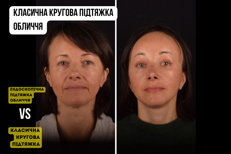 Фото: клініка пластичної хірургії Цертус, Київ