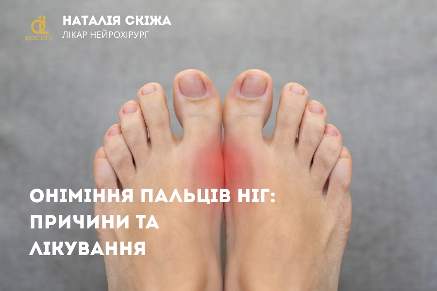 Оніміння пальців ніг: причини та лікування Оніміння пальців ніг: причини та лікування