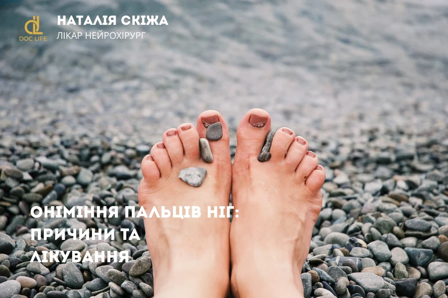 Хвороби, що викликають оніміння пальців ніг Хвороби, що викликають оніміння пальців ніг