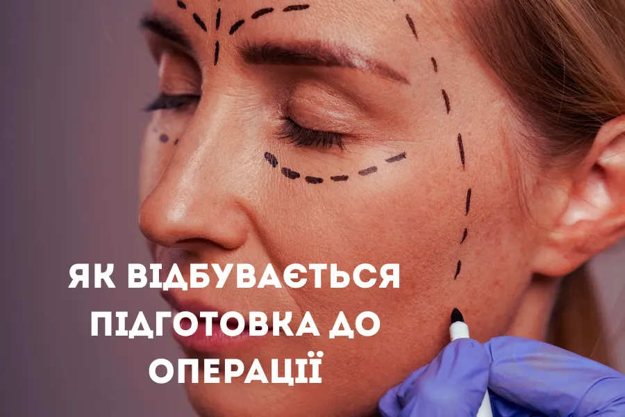 Як відбувається підготовка до операції