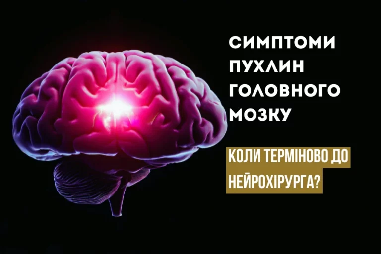 Симптоми пухлин головного мозку 1