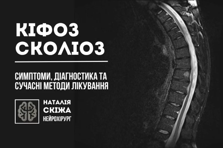 Кіфоз сколіоз Нейрохірург 1
