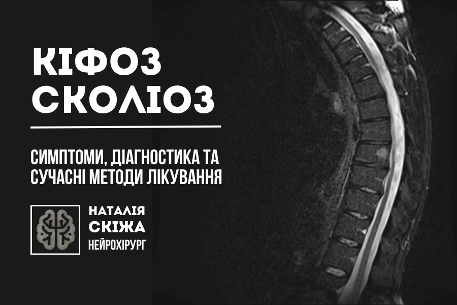 Кіфоз сколіоз Нейрохірург 1