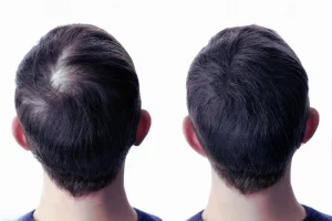 Трихолог у Львові: коли варто звернутися до спеціаліста - Нейрохірург Наталія Скіжа 2026