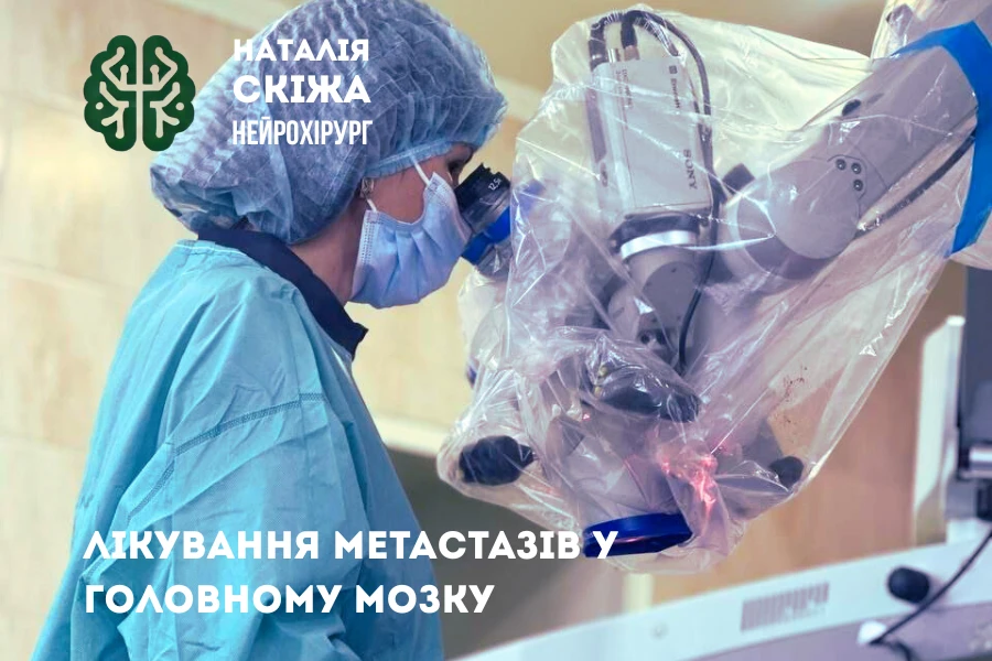 Лікування метастазів у головному мозку Лікування метастазів у головному мозку