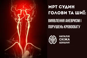 МРТ судин голови та шиї: виявлення аневризм і порушень кровообігу МРТ судин голови та шиї 1