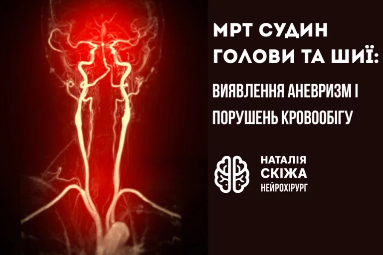 МРТ судин голови та шиї 1