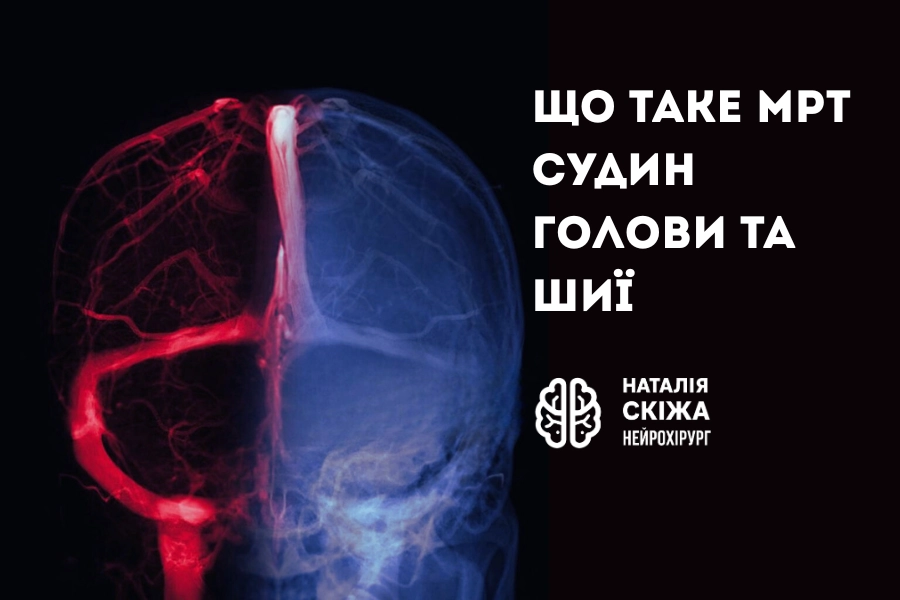 МРТ судин голови та шиї: виявлення аневризм і порушень кровообігу МРТ судин голови та шиї: виявлення аневризм і порушень кровообігу - Нейрохірург Наталія Скіжа Київ