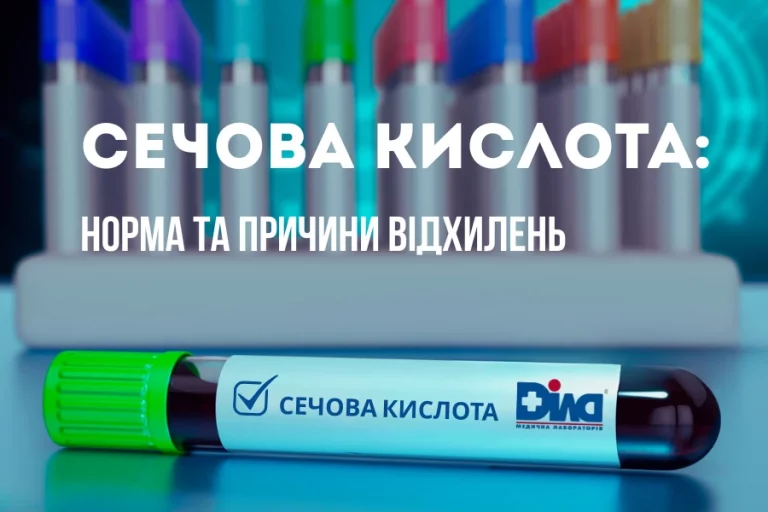сечова кислота