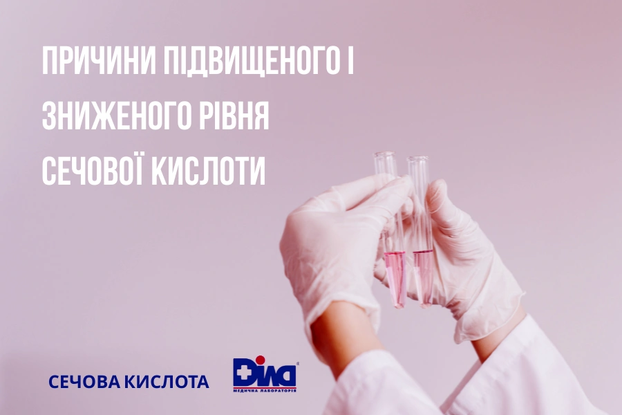 Причини підвищеного і зниженого рівня сечової кислоти Причини підвищеного і зниженого рівня сечової кислоти