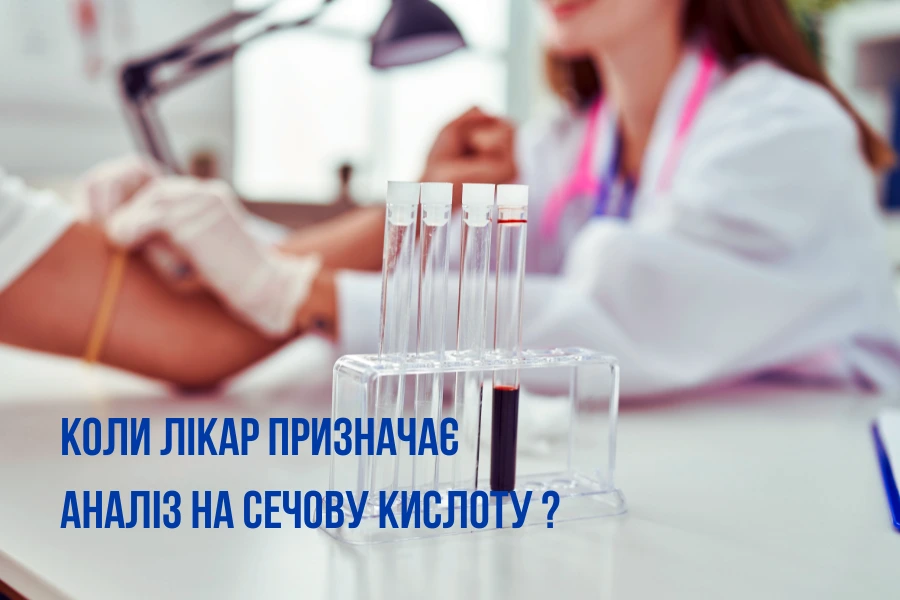 Коли лікар призначає аналіз на сечову кислоту? Коли лікар призначає аналіз на сечову кислоту?