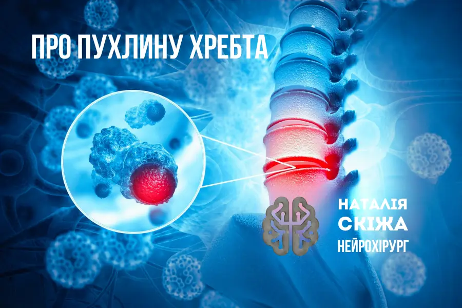 Коли біль у спині сигналізує про пухлину хребта Коли біль у спині сигналізує про пухлину хребта
