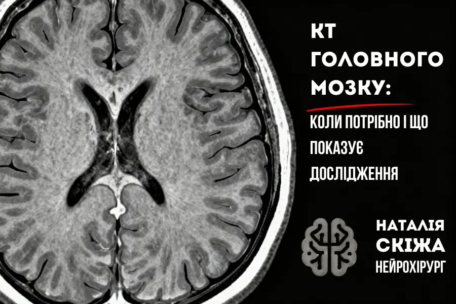 КТ головного мозку: коли потрібно і що показує дослідження КТ головного мозку: коли потрібно і що показує дослідження