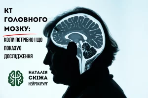 КТ головного мозку: коли потрібно і що показує дослідження кт головного мозку наталія скіжа 4