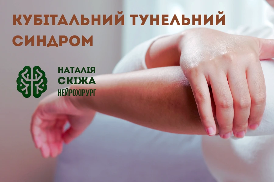 кубітальний тунельний синдром 1
