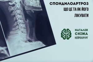 Спондилоартроз: що це та як його лікувати Спондилоартроз Наталія Скіжа Київ 5