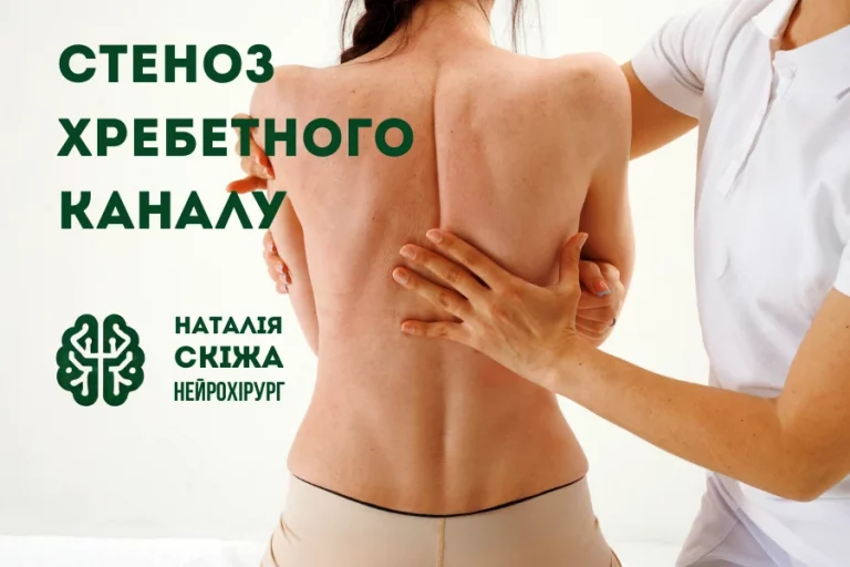 стеноз хребетного каналу 1