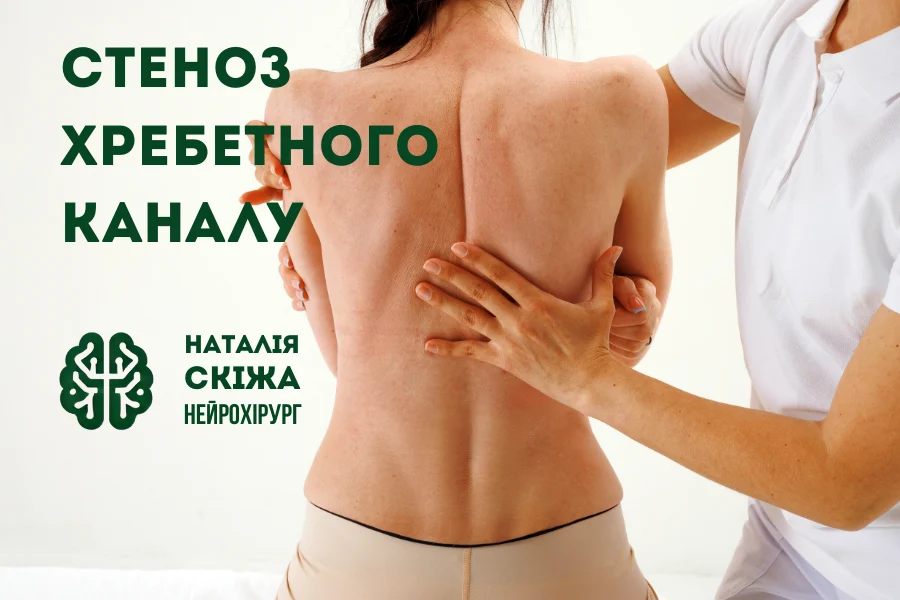 Стеноз хребетного каналу: симптоми, МРТ-діагностика та лікування стеноз хребетного каналу 1