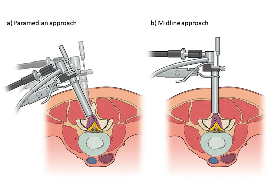 Порада від нейрохірурга Наталії Скіжа Порада від нейрохірурга Наталії Скіжа