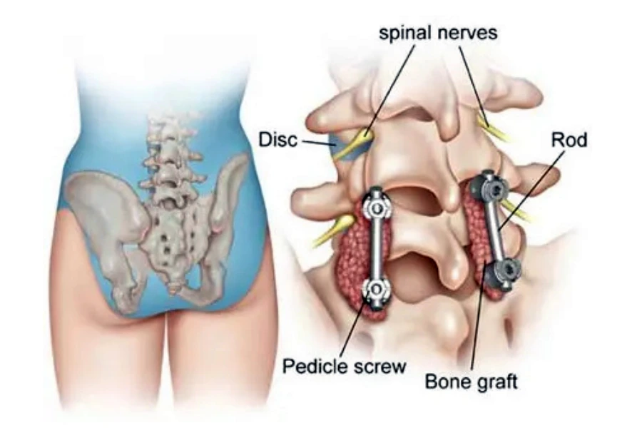 Причини компресії нервів Причини компресії нервів