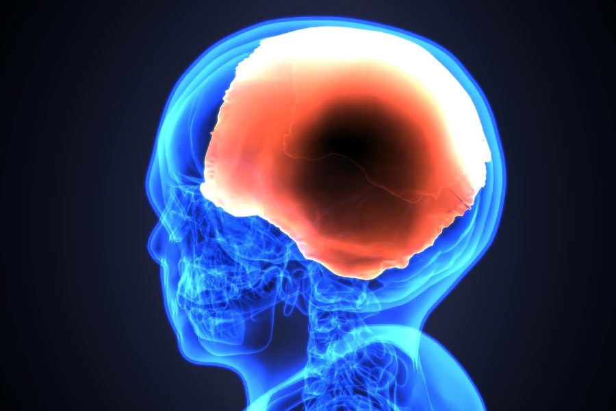 Суть операції шунтування мозку