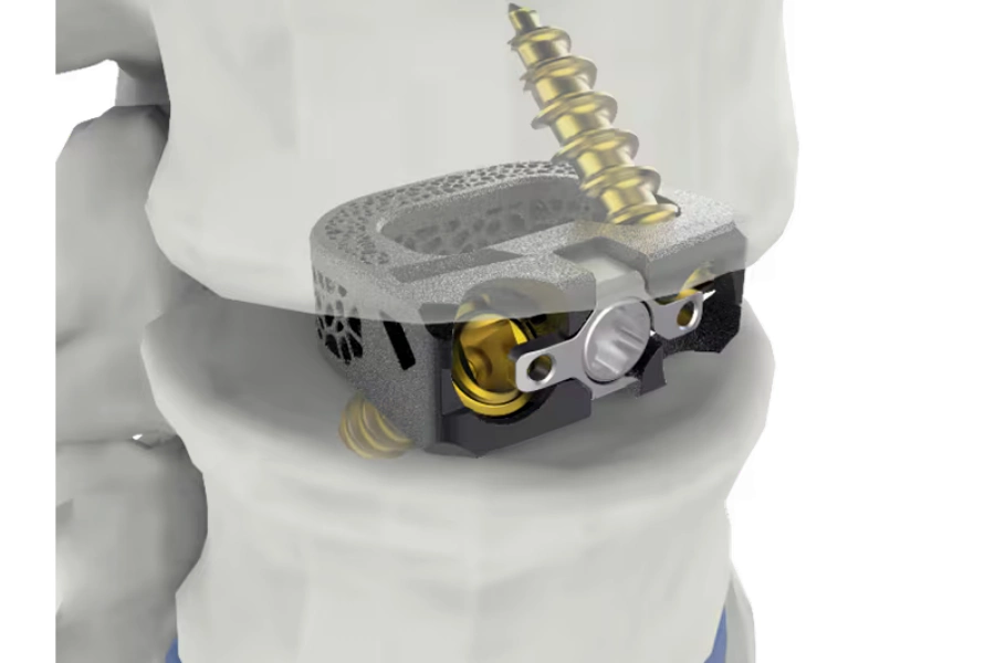 Матеріали і типи кейджів