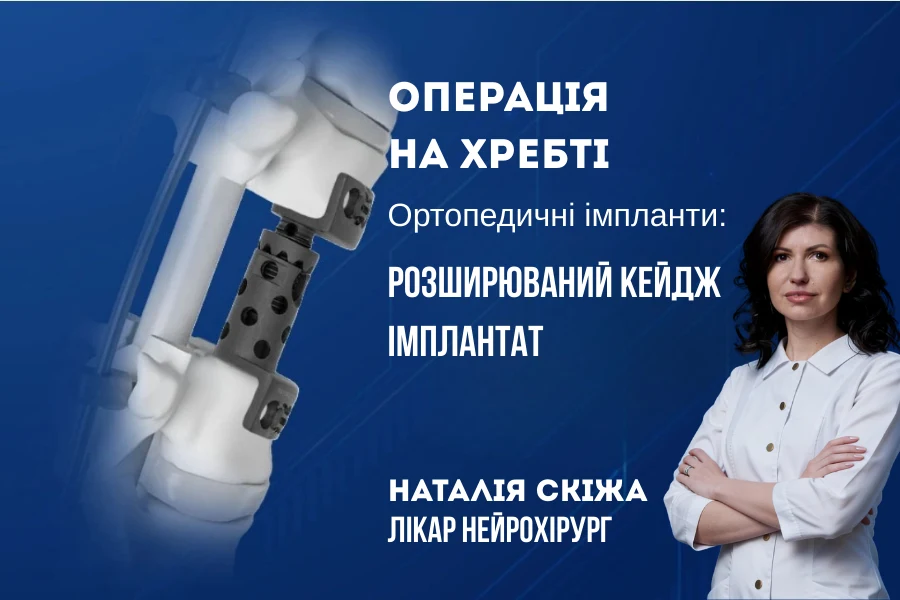 Кейджі та імпланти для хребта: сучасні технології стабілізації