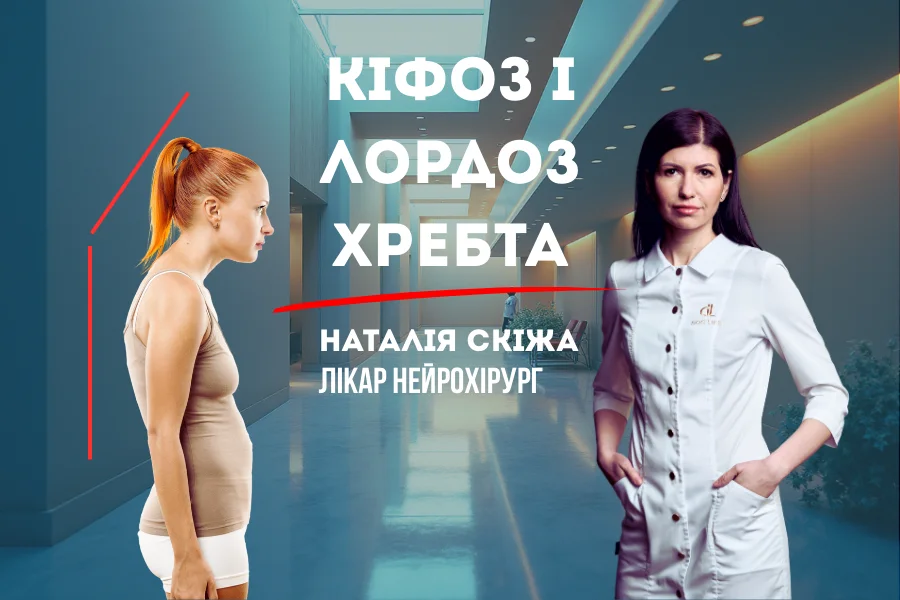 Кіфоз і лордоз: норма чи патологія? Причини, діагностика та лікування Кіфоз і лордоз: норма чи патологія? Причини, діагностика та лікування