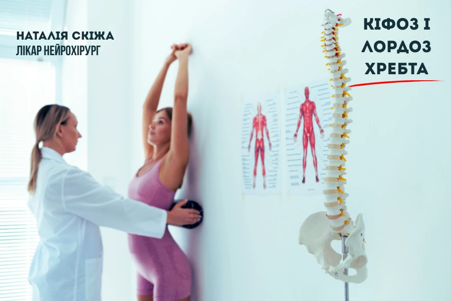 Кіфоз і лордоз хребта - Як виявити патологію Кіфоз і лордоз хребта - Як виявити патологію
