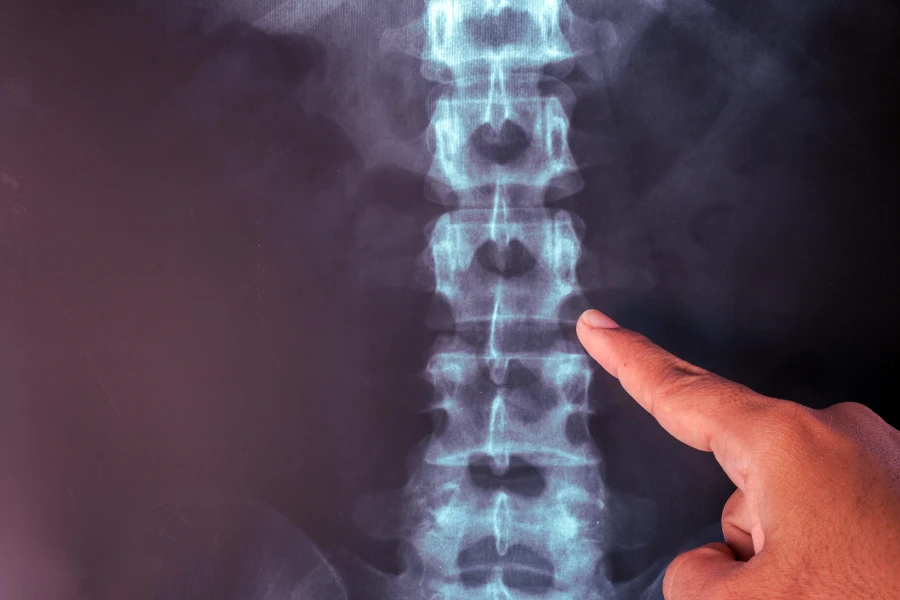 Що таке метастази і як вони виникають