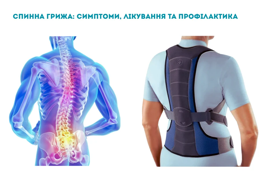 Спинна грижа: симптоми, лікування та профілактика - Нейрохірург Наталія Скіжа 2026