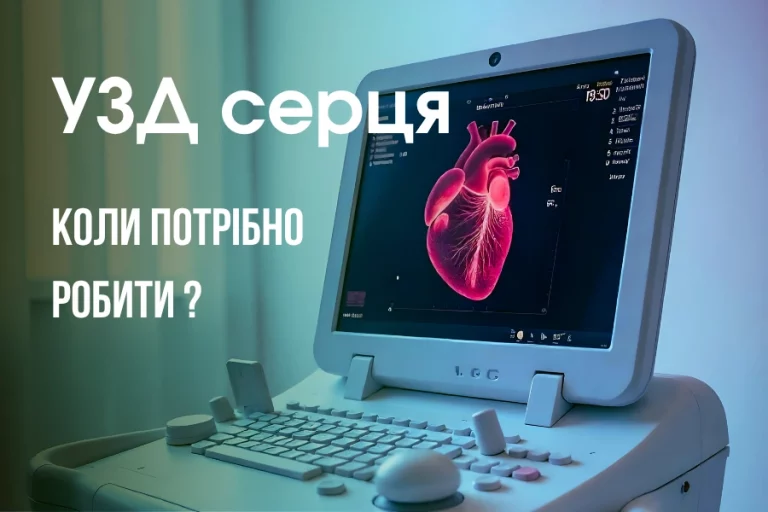 Коли потрібно робити УЗД серця: симптоми, які не можна ігнорувати - Нейрохірург Наталія Скіжа 2026