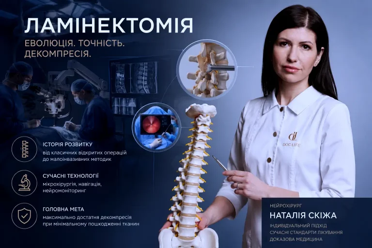ламінектомія наталія скіжа нейрохірург 00